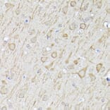 Immunohistochemistry - Anti-LC3B Antibody (A80423) - Antibodies.com