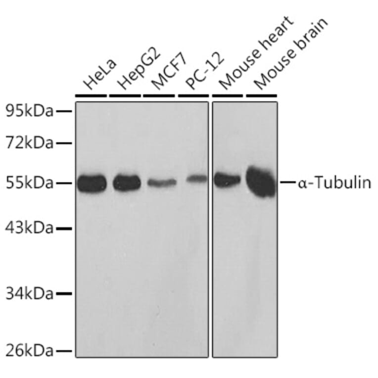 Western Blot - Anti-alpha Tubulin Antibody (A80425) - Antibodies.com