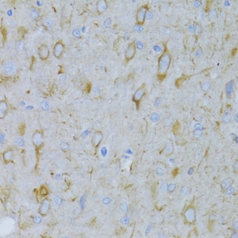 Immunohistochemistry - Anti-alpha Tubulin Antibody (A80425) - Antibodies.com