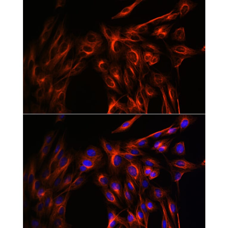 Immunofluorescence - Anti-alpha Tubulin Antibody (A80425) - Antibodies.com