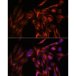 Immunofluorescence - Anti-alpha Tubulin Antibody (A80425) - Antibodies.com