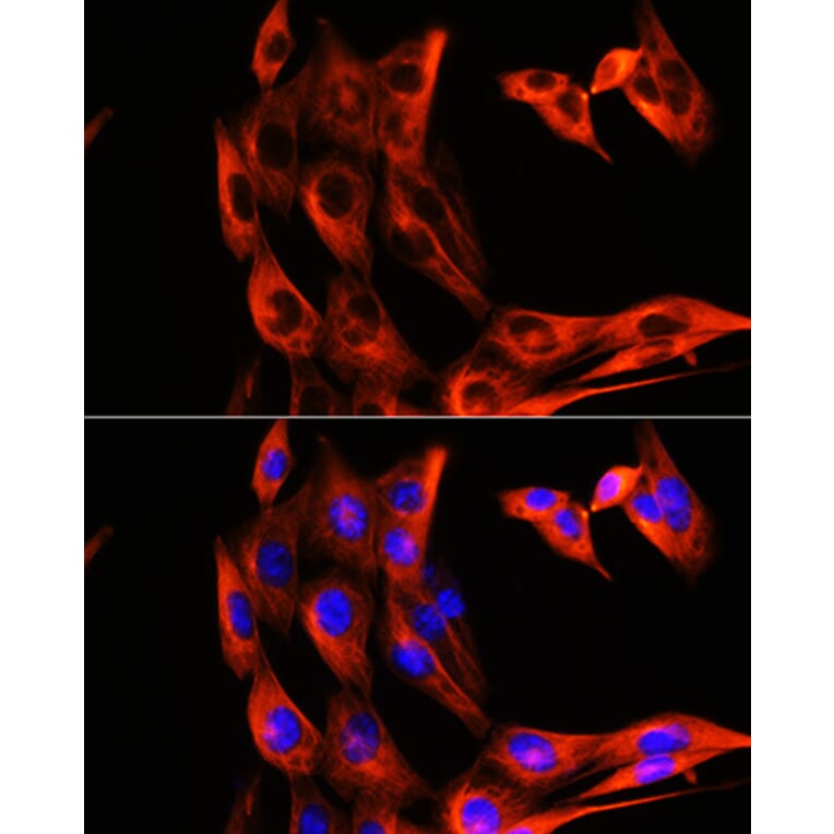 Immunofluorescence - Anti-alpha Tubulin Antibody (A80425) - Antibodies.com