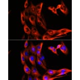 Immunofluorescence - Anti-alpha Tubulin Antibody (A80425) - Antibodies.com