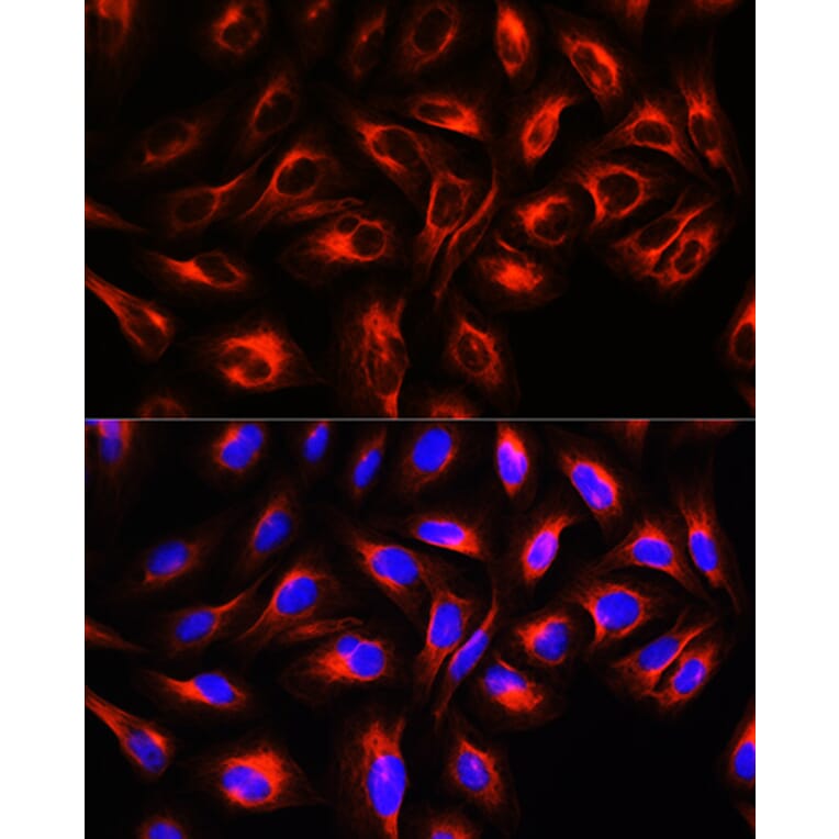 Immunofluorescence - Anti-alpha Tubulin Antibody (A80425) - Antibodies.com