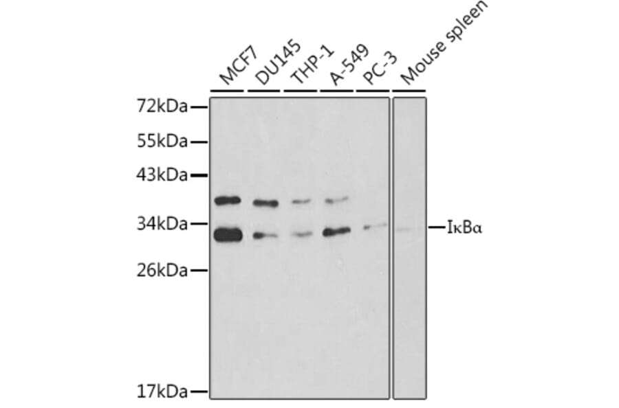 Western Blot - Anti-IKB alpha Antibody (A80427) - Antibodies.com