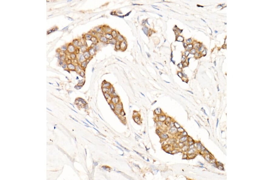 Immunohistochemistry - Anti-IKB alpha Antibody (A80427) - Antibodies.com
