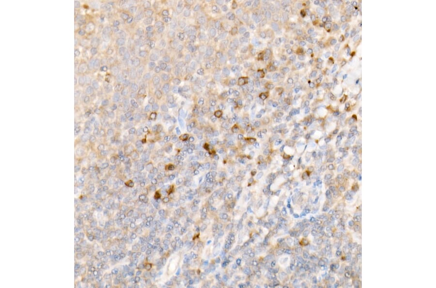 Immunohistochemistry - Anti-IKB alpha Antibody (A80427) - Antibodies.com