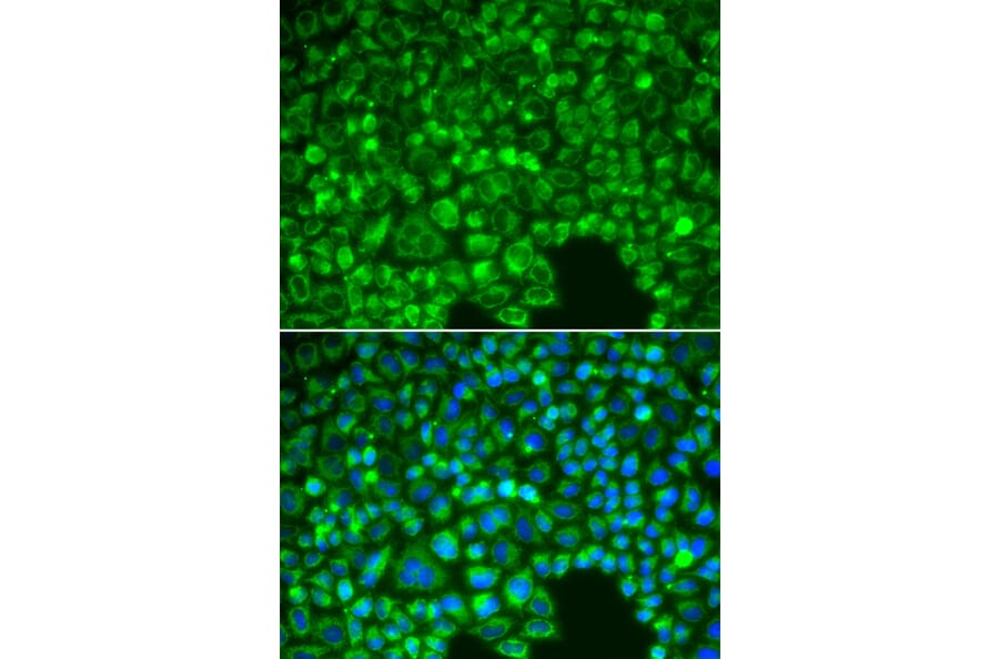 Immunofluorescence - Anti-IKB alpha Antibody (A80427) - Antibodies.com