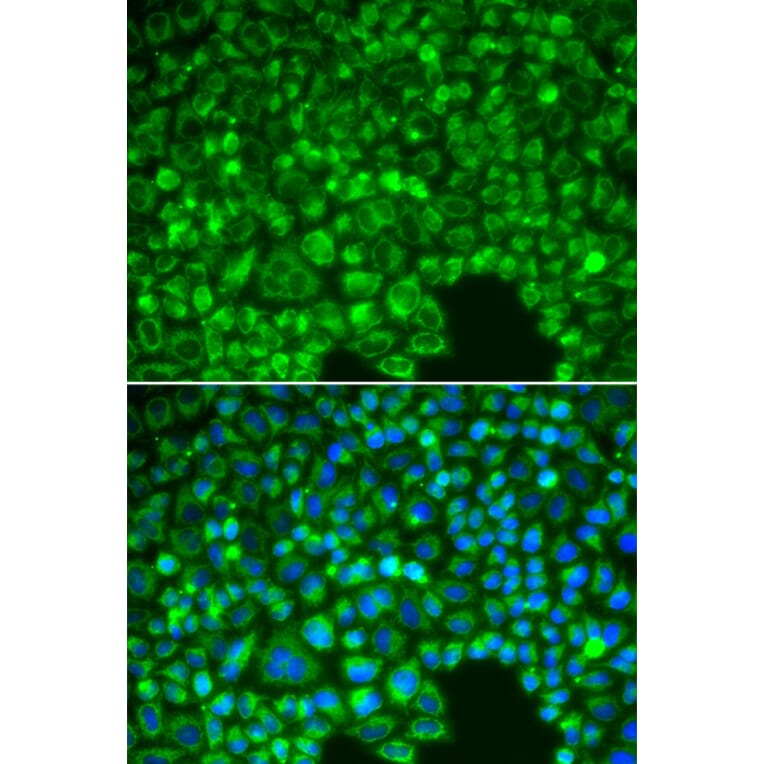 Immunofluorescence - Anti-IKB alpha Antibody (A80427) - Antibodies.com