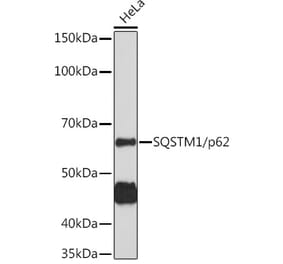 Western Blot - Anti-SQSTM1 / p62 Antibody (A80428) - Antibodies.com
