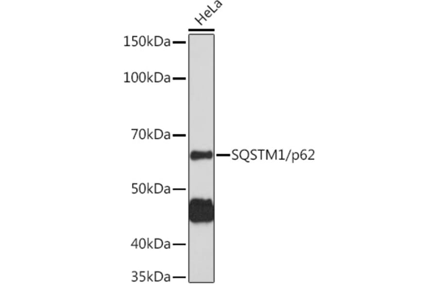 Western Blot - Anti-SQSTM1 / p62 Antibody (A80428) - Antibodies.com