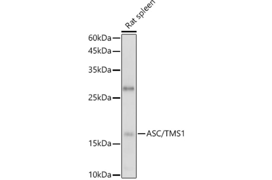 Western Blot - Anti-TMS1 / ASC Antibody (A80429) - Antibodies.com