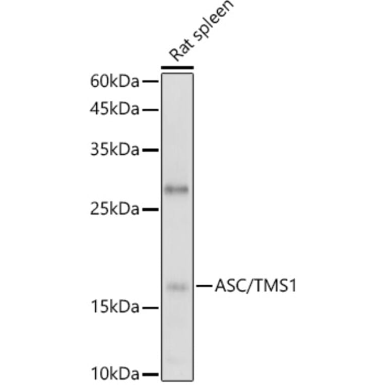 Western Blot - Anti-TMS1 / ASC Antibody (A80429) - Antibodies.com