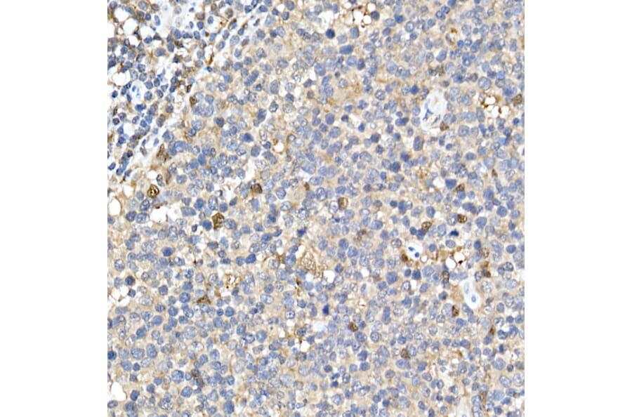 Immunohistochemistry - Anti-TMS1 / ASC Antibody (A80429) - Antibodies.com