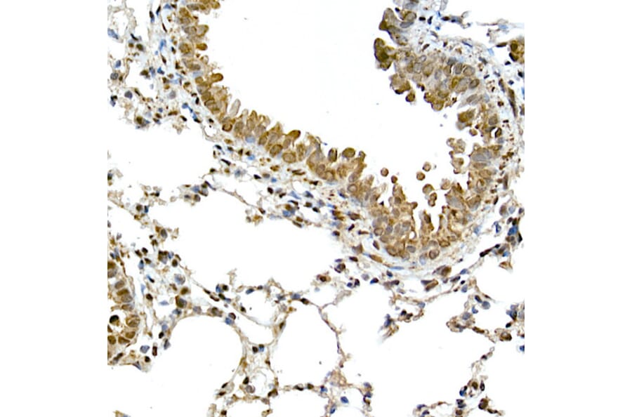 Immunohistochemistry - Anti-TMS1 / ASC Antibody (A80429) - Antibodies.com