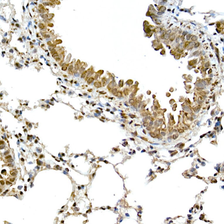 Immunohistochemistry - Anti-TMS1 / ASC Antibody (A80429) - Antibodies.com