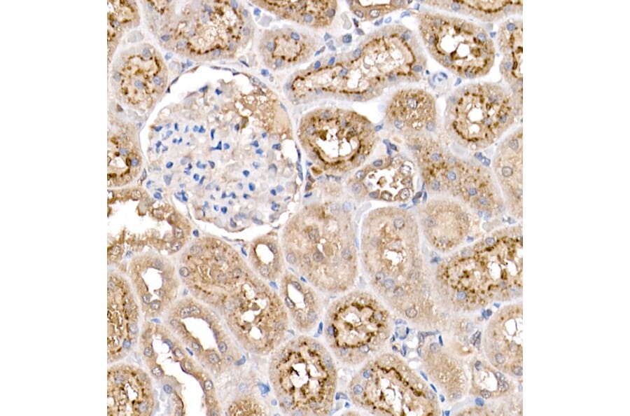 Immunohistochemistry - Anti-TMS1 / ASC Antibody (A80429) - Antibodies.com