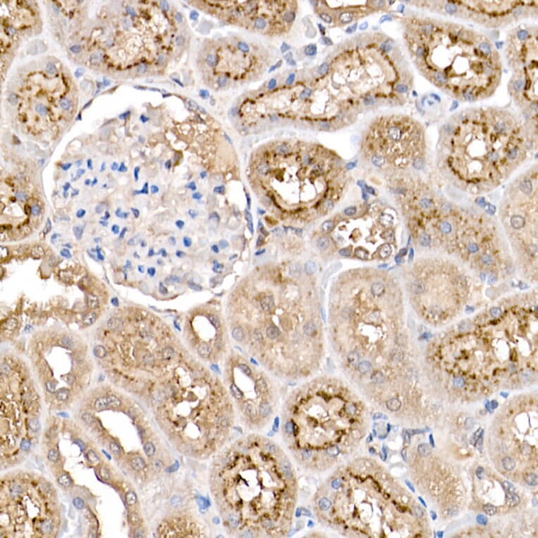 Immunohistochemistry - Anti-TMS1 / ASC Antibody (A80429) - Antibodies.com