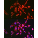 Immunofluorescence - Anti-TMS1 / ASC Antibody (A80429) - Antibodies.com