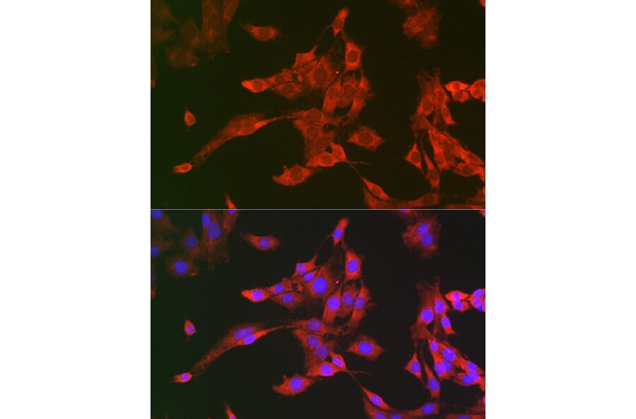 Immunofluorescence - Anti-TMS1 / ASC Antibody (A80429) - Antibodies.com
