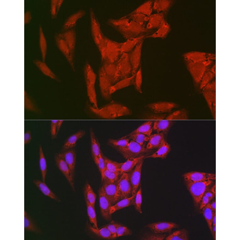 Immunofluorescence - Anti-TMS1 / ASC Antibody (A80429) - Antibodies.com
