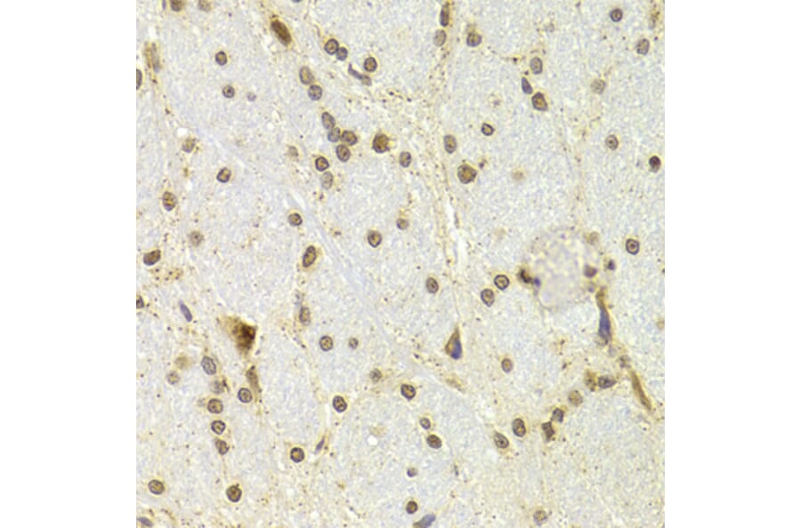 Immunohistochemistry - Anti-CDKN1A Antibody (A11454) - Antibodies.com