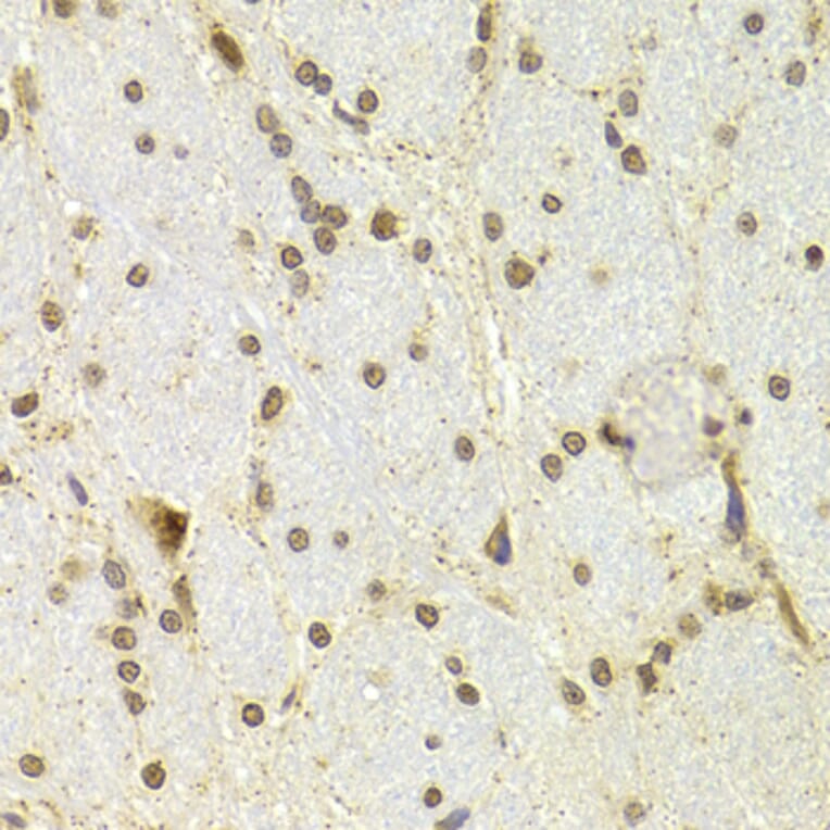 Immunohistochemistry - Anti-CDKN1A Antibody (A11454) - Antibodies.com