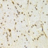 Immunohistochemistry - Anti-CDKN1A Antibody (A11454) - Antibodies.com