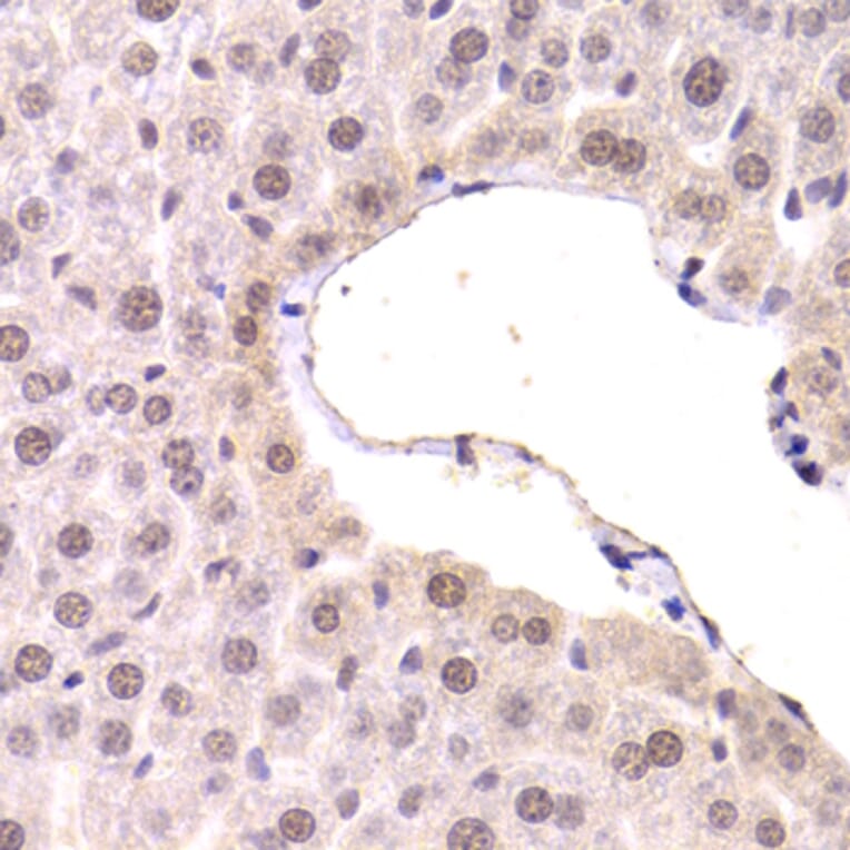 Immunohistochemistry - Anti-CDKN1A Antibody (A11454) - Antibodies.com