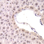 Immunohistochemistry - Anti-CDKN1A Antibody (A11454) - Antibodies.com