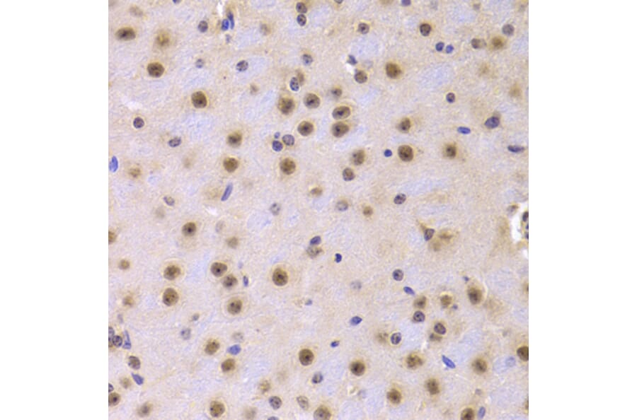 Immunohistochemistry - Anti-CDKN1A Antibody (A11454) - Antibodies.com