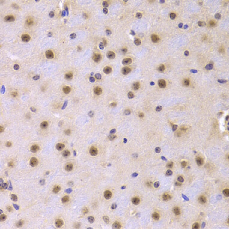 Immunohistochemistry - Anti-CDKN1A Antibody (A11454) - Antibodies.com