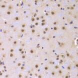 Immunohistochemistry - Anti-CDKN1A Antibody (A11454) - Antibodies.com