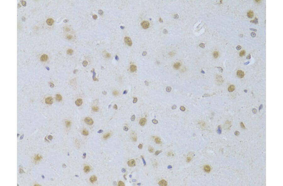 Immunohistochemistry - Anti-CDKN1A Antibody (A11454) - Antibodies.com