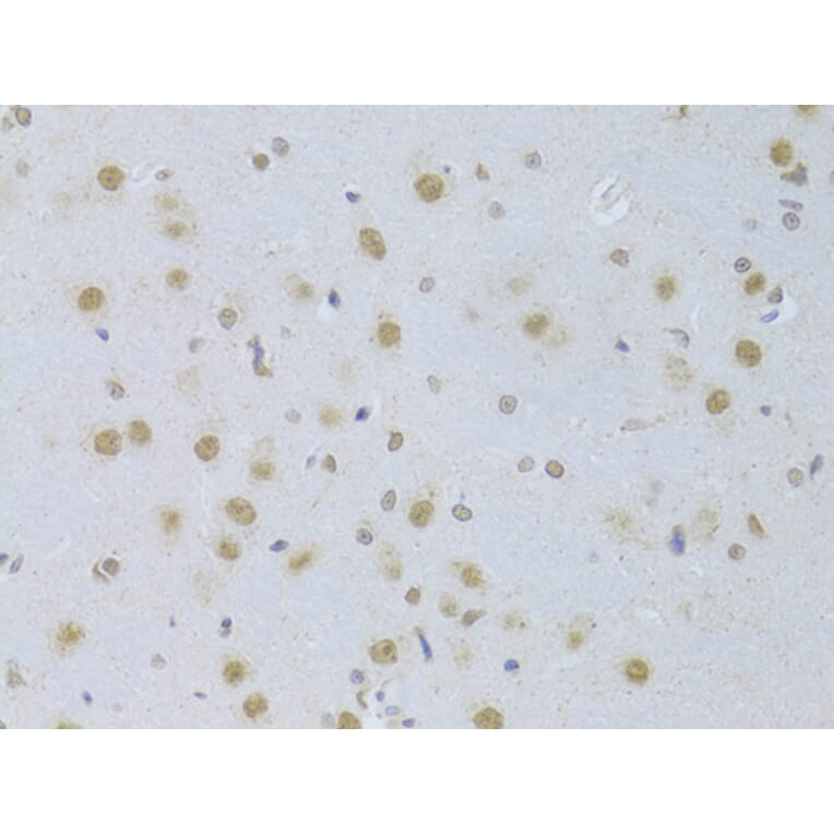 Immunohistochemistry - Anti-CDKN1A Antibody (A11454) - Antibodies.com