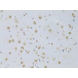 Immunohistochemistry - Anti-CDKN1A Antibody (A11454) - Antibodies.com