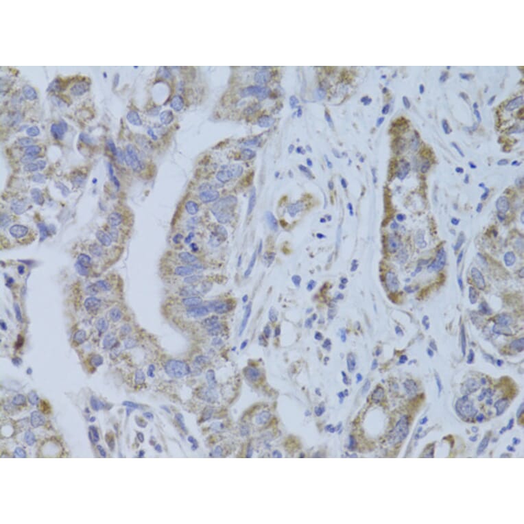 Immunohistochemistry - Anti-CDKN1A Antibody (A11454) - Antibodies.com