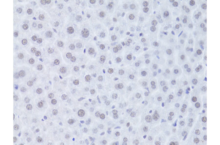 Immunohistochemistry - Anti-CDKN1A Antibody (A11454) - Antibodies.com