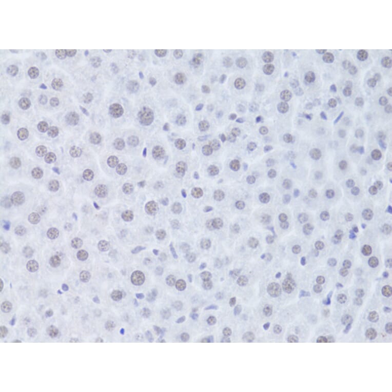 Immunohistochemistry - Anti-CDKN1A Antibody (A11454) - Antibodies.com