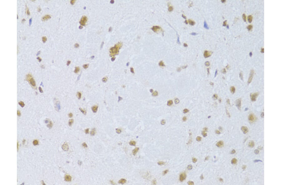 Immunohistochemistry - Anti-CDKN1A Antibody (A11454) - Antibodies.com