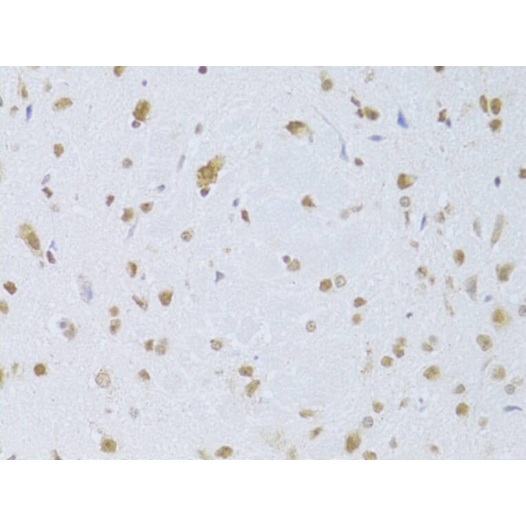 Immunohistochemistry - Anti-CDKN1A Antibody (A11454) - Antibodies.com