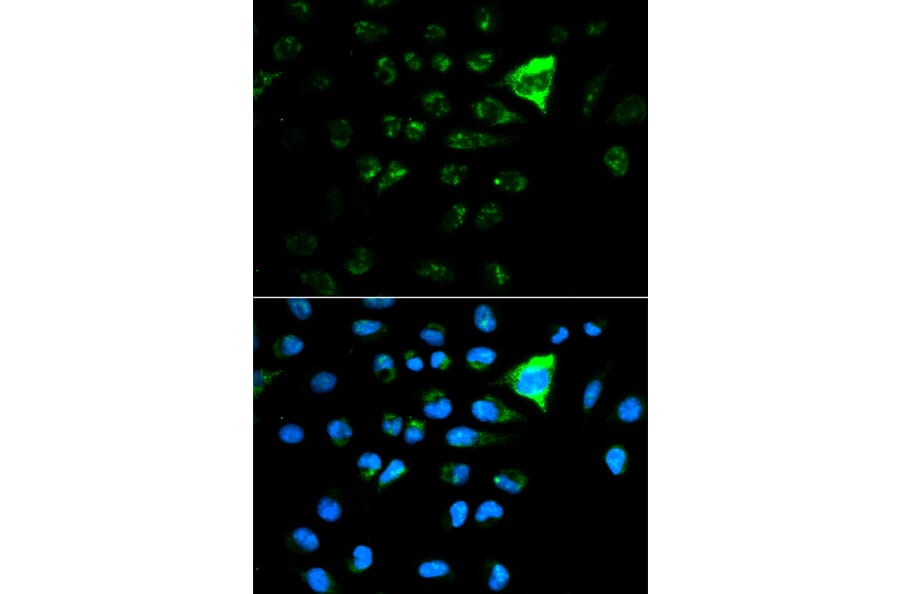 Immunofluorescence - Anti-CDKN1A Antibody (A11454) - Antibodies.com