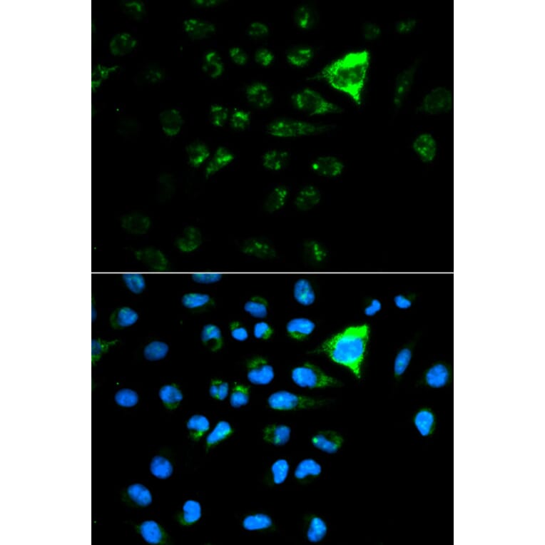 Immunofluorescence - Anti-CDKN1A Antibody (A11454) - Antibodies.com