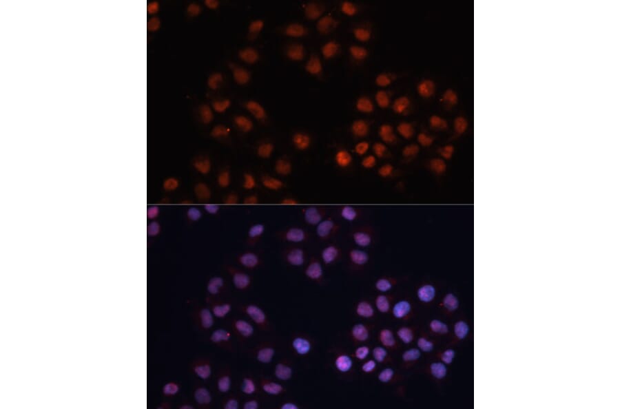 Immunofluorescence - Anti-CDKN1A Antibody (A11454) - Antibodies.com
