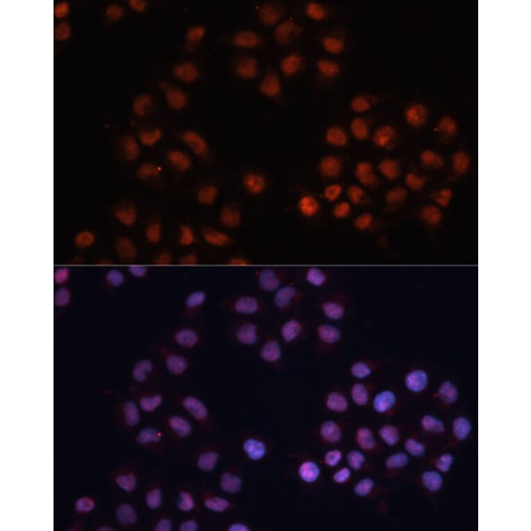 Immunofluorescence - Anti-CDKN1A Antibody (A11454) - Antibodies.com