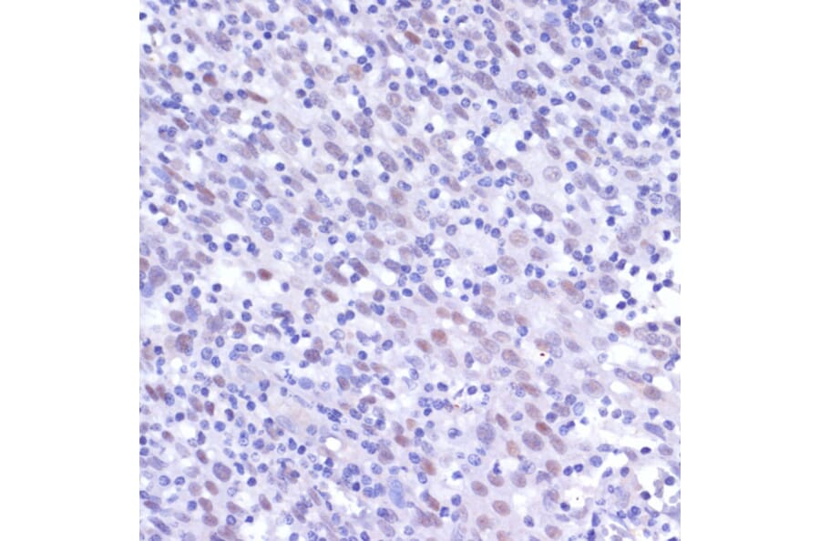 Immunohistochemistry - Anti-NFkB p105/p50 Antibody (A80434) - Antibodies.com