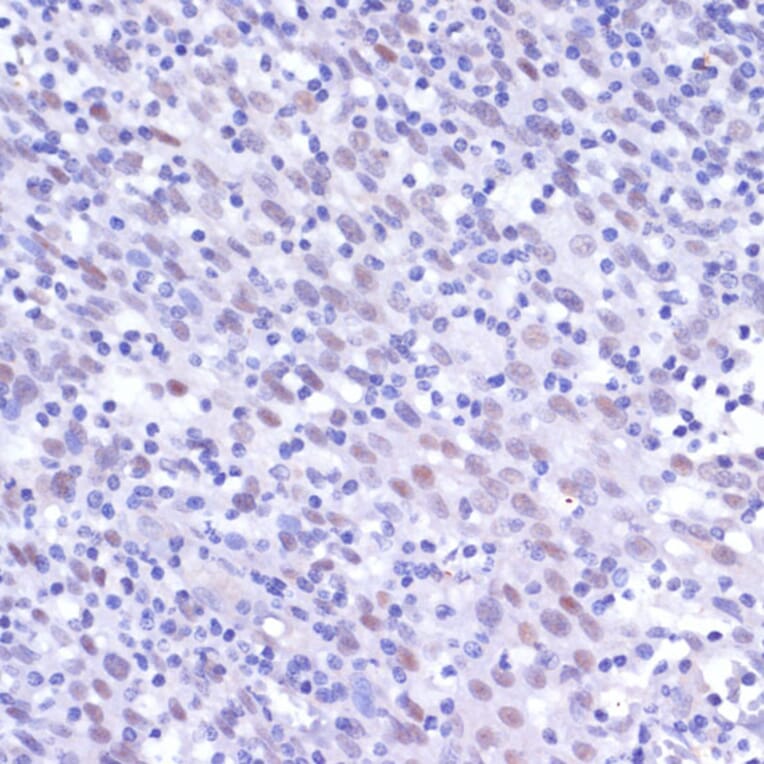 Immunohistochemistry - Anti-NFkB p105 / p50 Antibody (A80434) - Antibodies.com