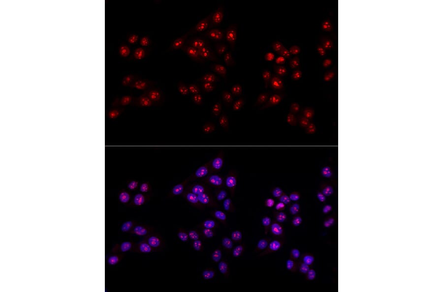 Immunofluorescence - Anti-Ki67 Antibody (A80435) - Antibodies.com