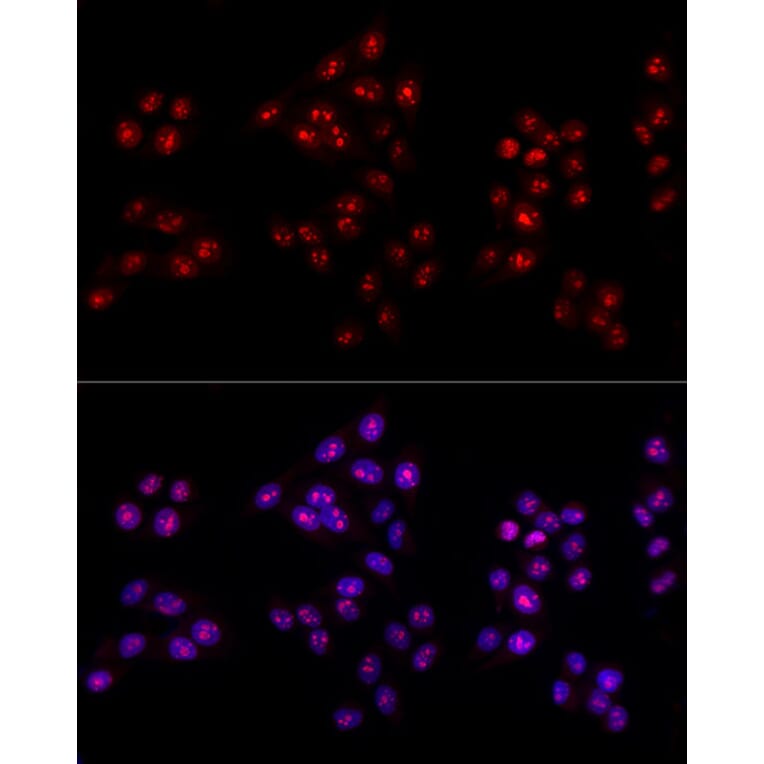 Immunofluorescence - Anti-Ki67 Antibody (A80435) - Antibodies.com