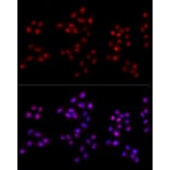 Immunofluorescence - Anti-Ki67 Antibody (A80435) - Antibodies.com